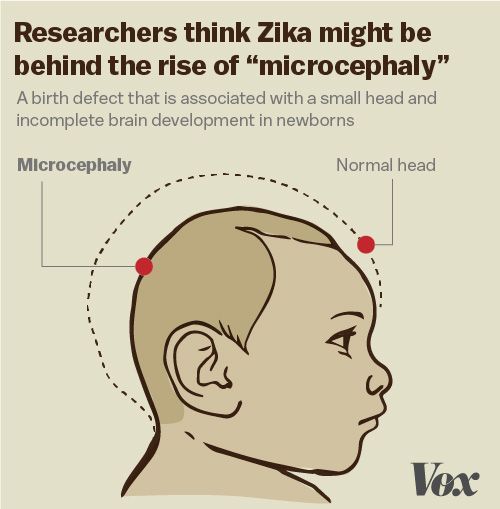 Zika Virus Update